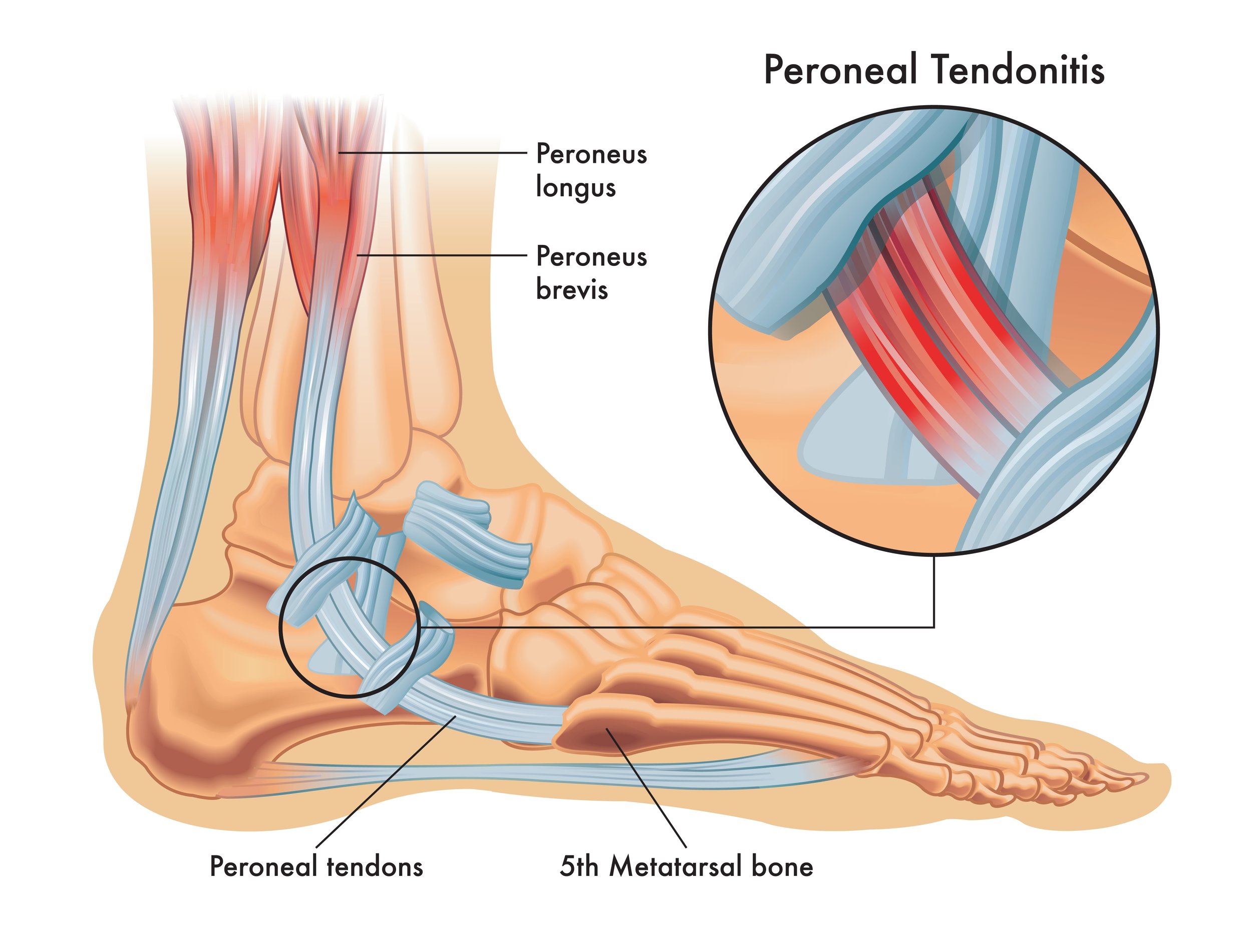 Peroneal tendons medical illustration